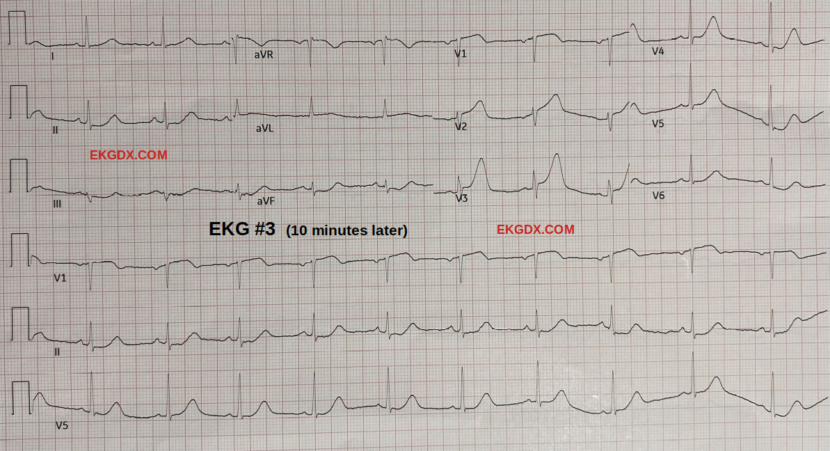 EKGDX - The new era of EKG learning